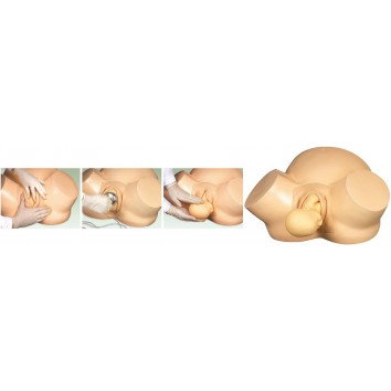 CHILDBIRTH TRAINING SIMULATOR (SOFT)